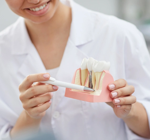 Dentist in white coat holding dental implant model, explaining tooth replacement procedure.